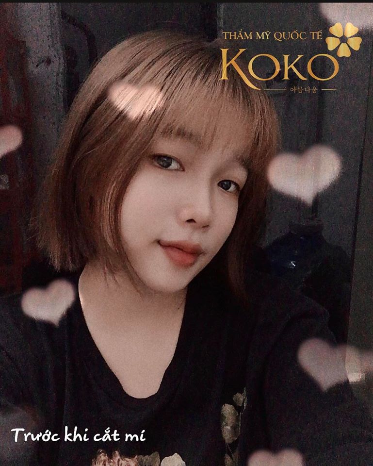 Thẩm Mỹ Ko Ko – Nét Đẹp Hoàn Mỹ