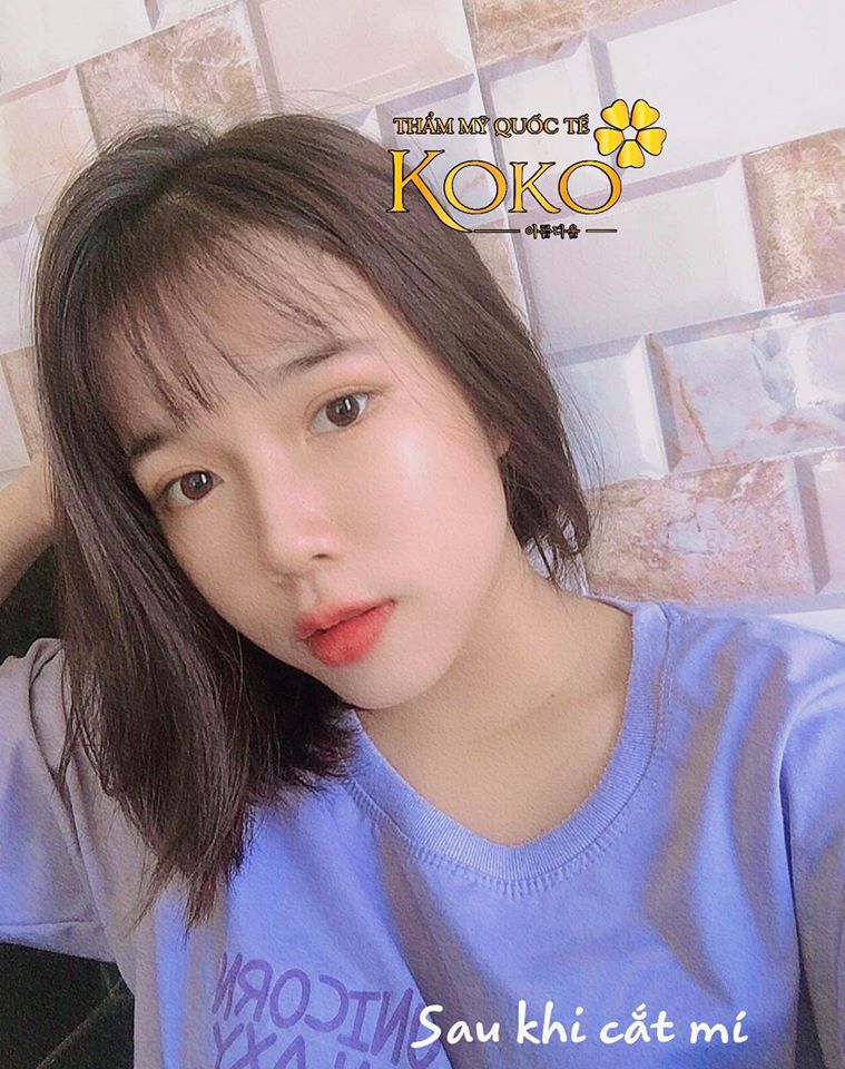 Thẩm Mỹ Ko Ko – Nét Đẹp Hoàn Mỹ