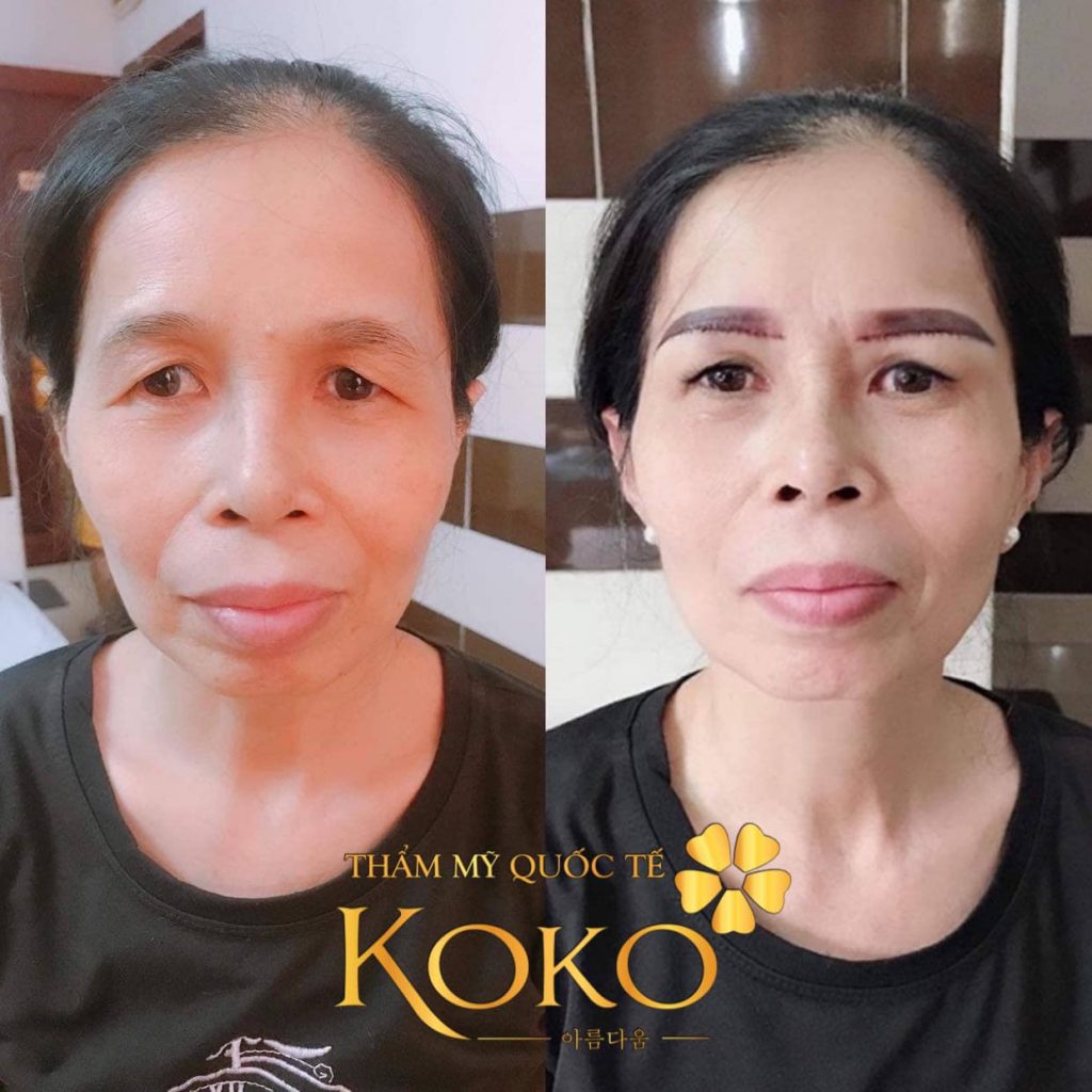 treo cung mày