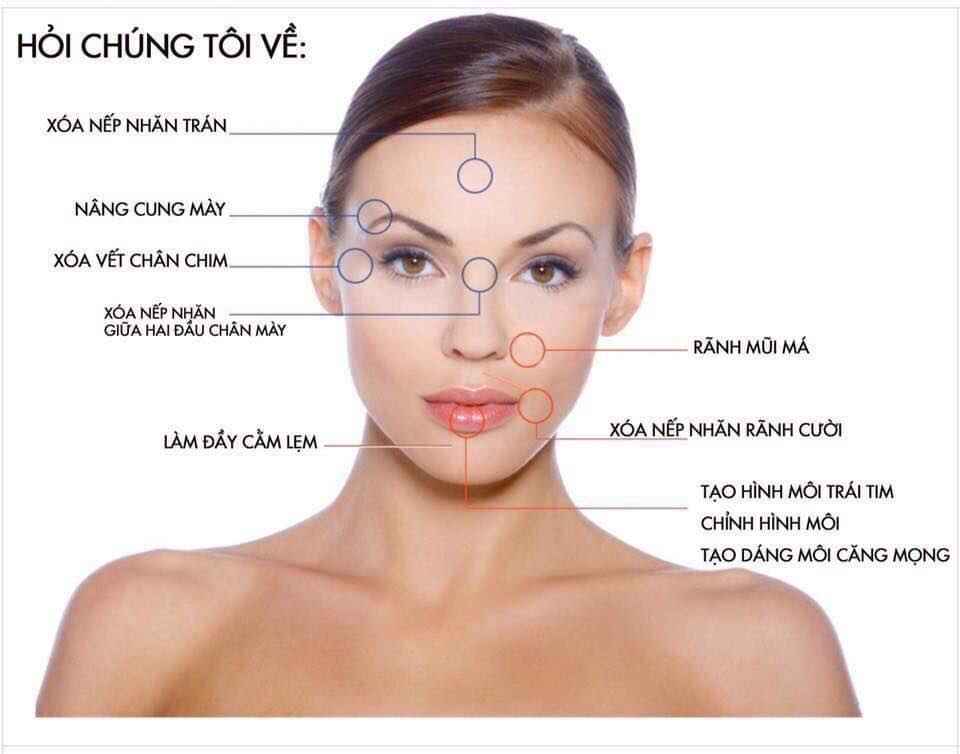tiêm fille taoj hình khuôn mặt