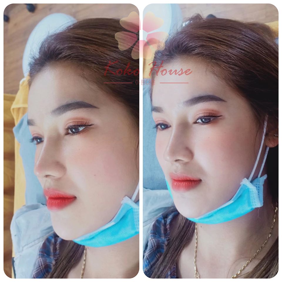 Thẩm Mỹ Ko Ko – Nét Đẹp Hoàn Mỹ