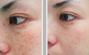 Thẩm Mỹ Ko Ko – Nét Đẹp Hoàn Mỹ