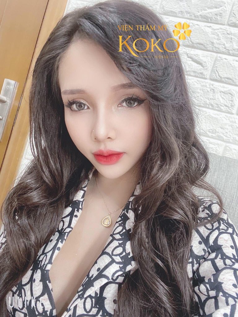 Thẩm Mỹ Ko Ko – Nét Đẹp Hoàn Mỹ
