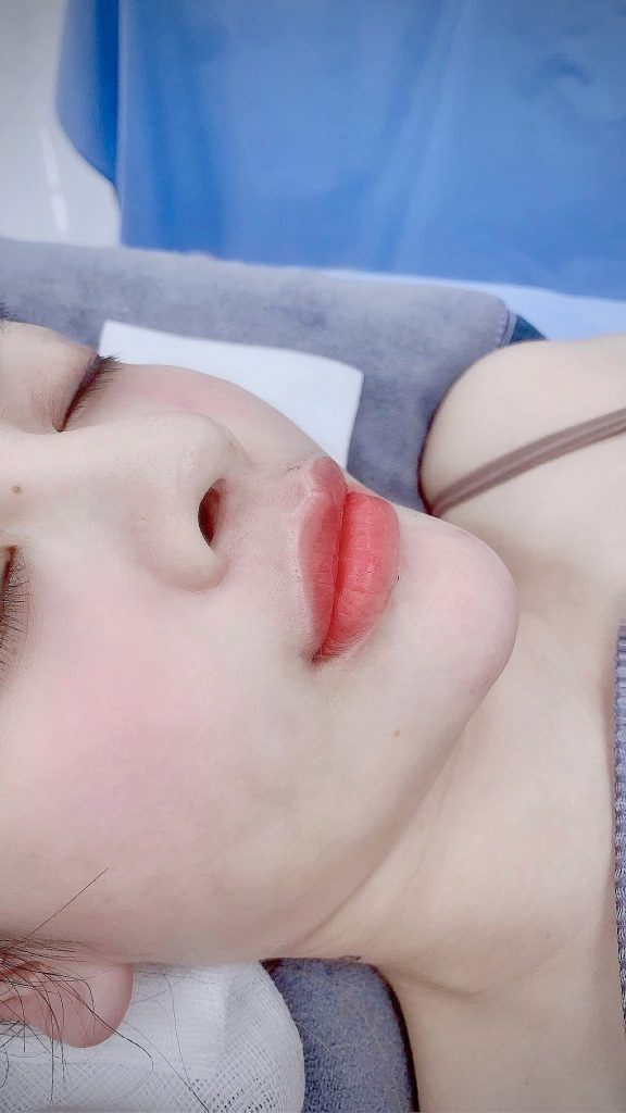 Thẩm Mỹ Ko Ko – Nét Đẹp Hoàn Mỹ