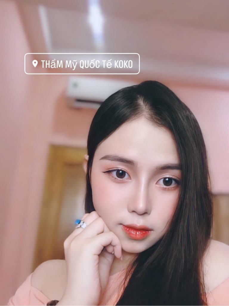 Thẩm Mỹ Ko Ko – Nét Đẹp Hoàn Mỹ