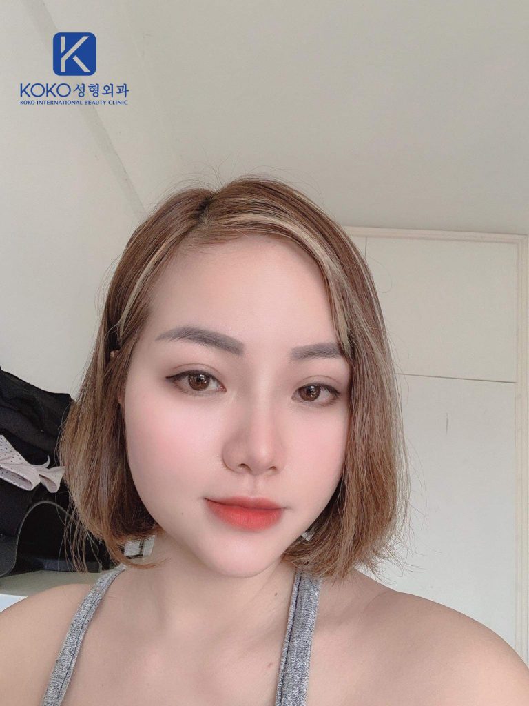 Thẩm Mỹ Ko Ko – Nét Đẹp Hoàn Mỹ