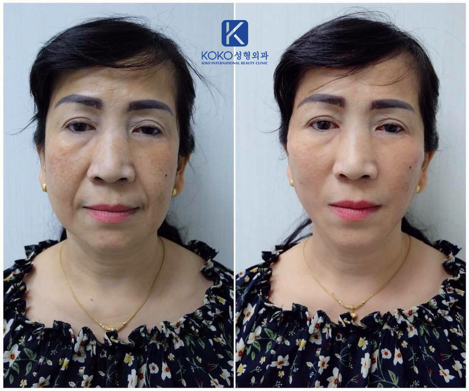 Thẩm Mỹ Ko Ko – Nét Đẹp Hoàn Mỹ