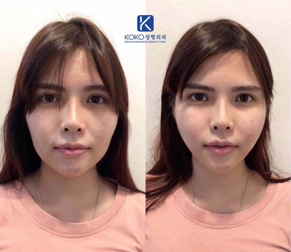 Thẩm Mỹ Ko Ko – Nét Đẹp Hoàn Mỹ