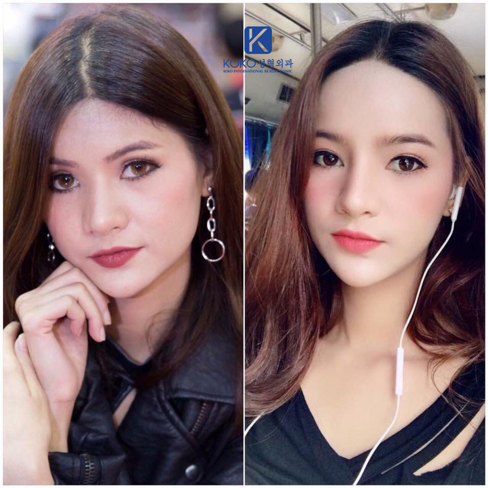 Thẩm Mỹ Ko Ko – Nét Đẹp Hoàn Mỹ