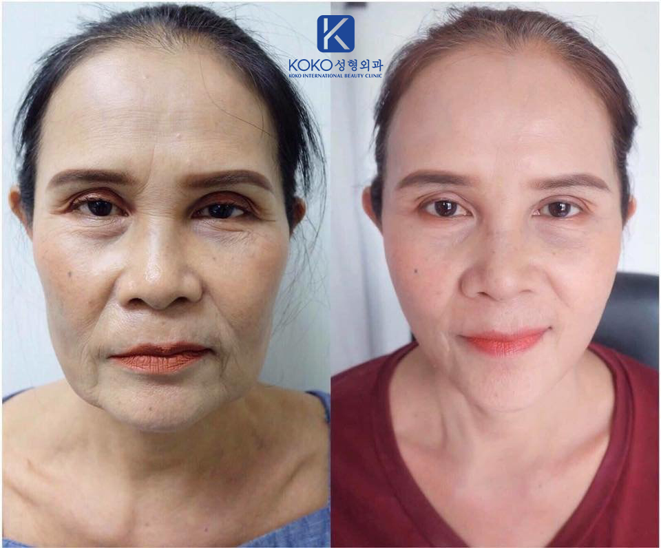 Thẩm Mỹ Ko Ko – Nét Đẹp Hoàn Mỹ