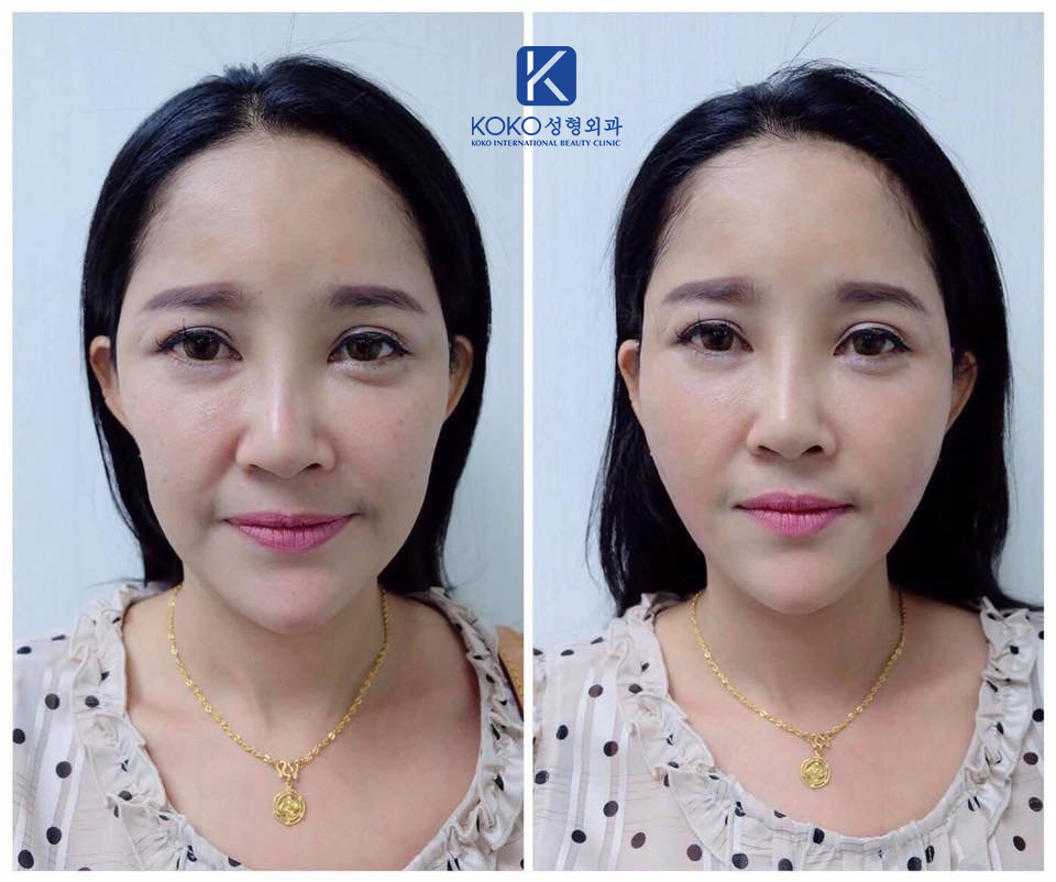 Thẩm Mỹ Ko Ko – Nét Đẹp Hoàn Mỹ