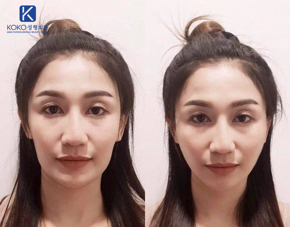 Thẩm Mỹ Ko Ko – Nét Đẹp Hoàn Mỹ