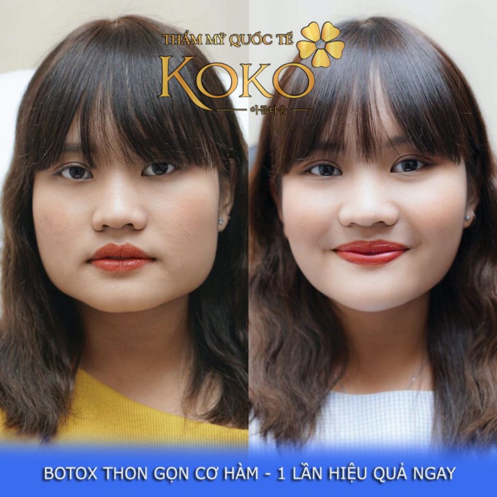 Thẩm Mỹ Ko Ko – Nét Đẹp Hoàn Mỹ