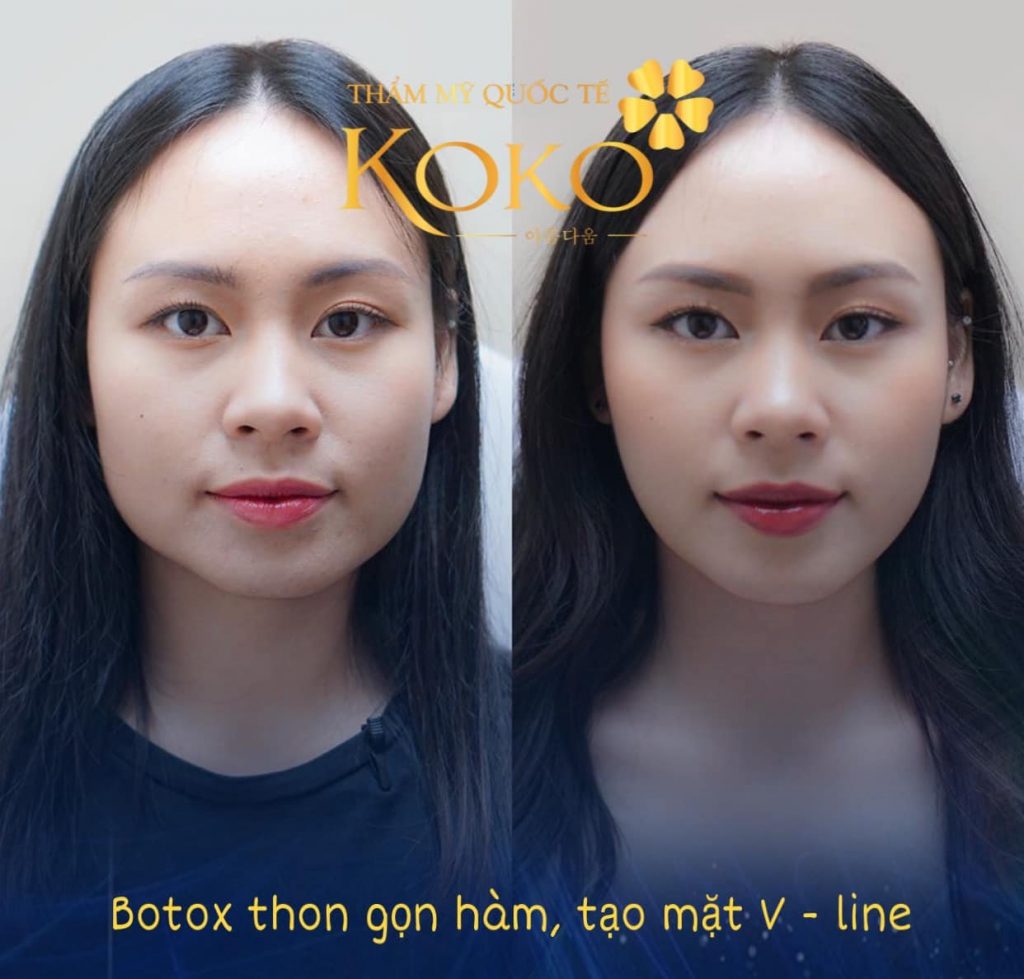 Thẩm Mỹ Ko Ko – Nét Đẹp Hoàn Mỹ