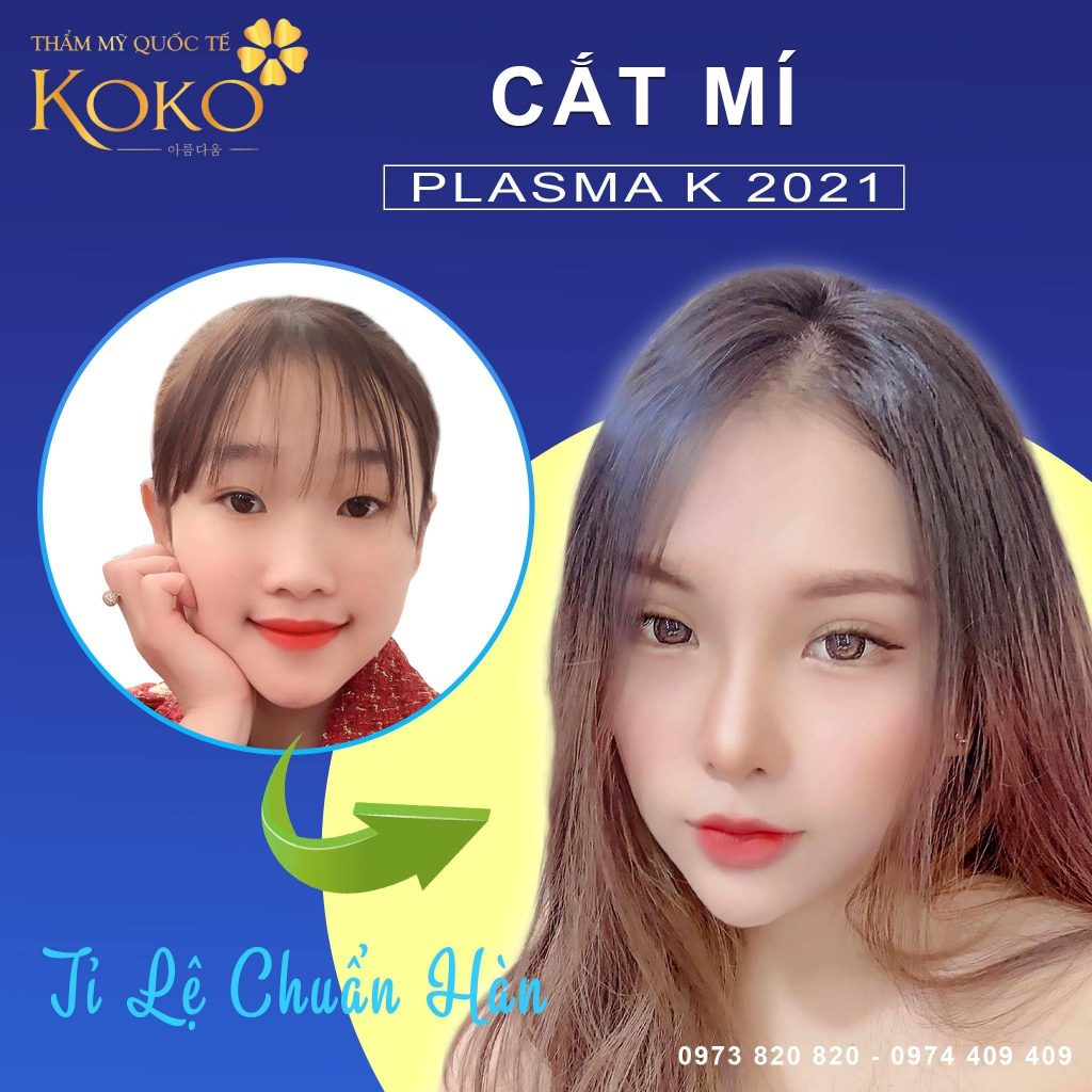 Thẩm Mỹ Ko Ko – Nét Đẹp Hoàn Mỹ