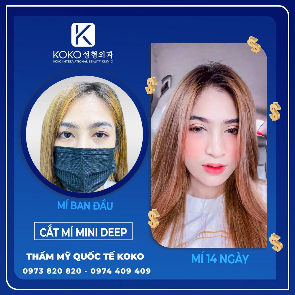 Thẩm Mỹ Ko Ko – Nét Đẹp Hoàn Mỹ
