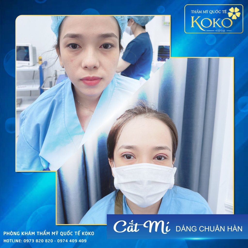 Thẩm Mỹ Ko Ko – Nét Đẹp Hoàn Mỹ