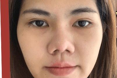 Thẩm Mỹ Ko Ko – Nét Đẹp Hoàn Mỹ