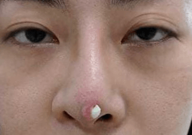 Thẩm Mỹ Ko Ko – Nét Đẹp Hoàn Mỹ