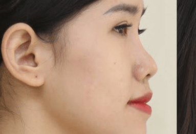 Thẩm Mỹ Ko Ko – Nét Đẹp Hoàn Mỹ