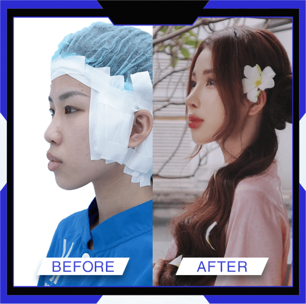 Thẩm Mỹ Ko Ko – Nét Đẹp Hoàn Mỹ