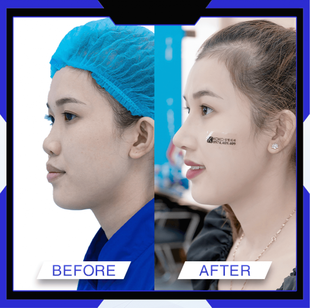 Thẩm Mỹ Ko Ko – Nét Đẹp Hoàn Mỹ