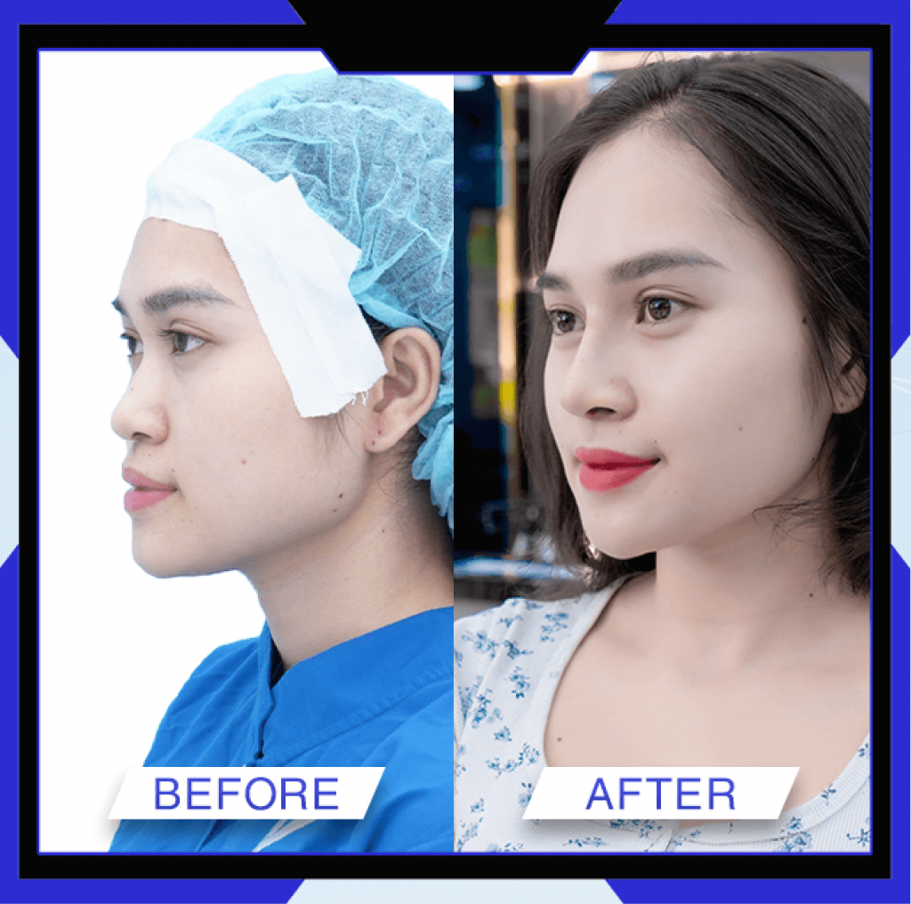 Thẩm Mỹ Ko Ko – Nét Đẹp Hoàn Mỹ