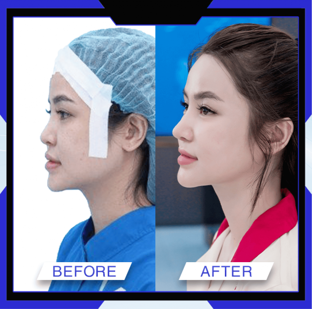 Thẩm Mỹ Ko Ko – Nét Đẹp Hoàn Mỹ