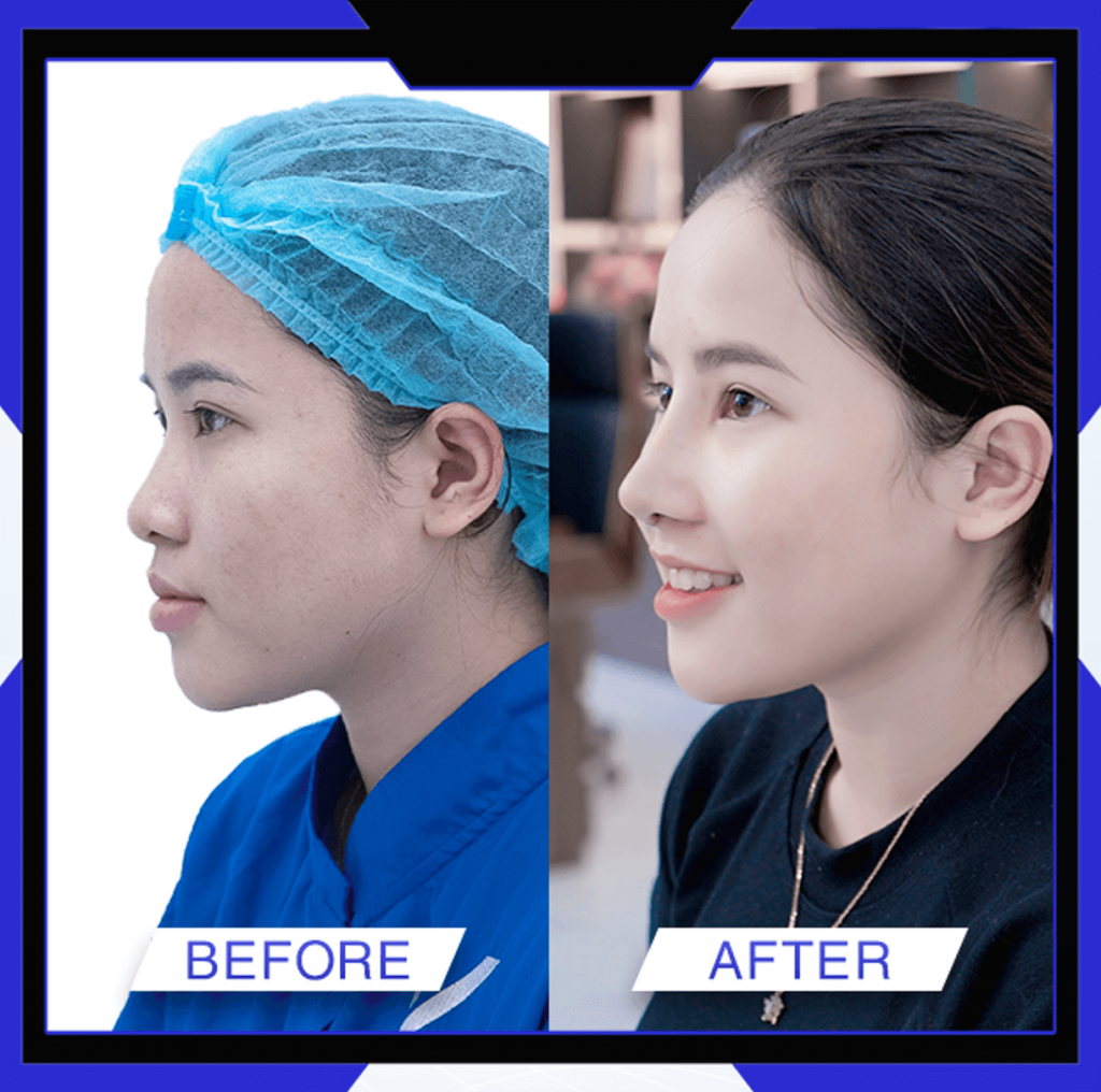 Thẩm Mỹ Ko Ko – Nét Đẹp Hoàn Mỹ