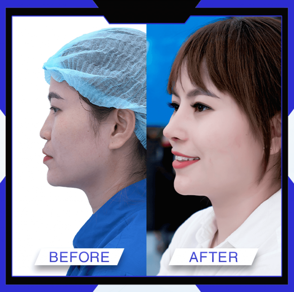 Thẩm Mỹ Ko Ko – Nét Đẹp Hoàn Mỹ