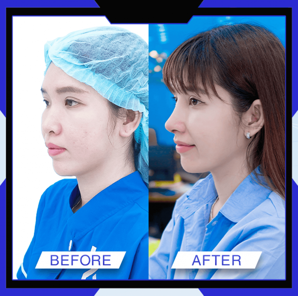 Thẩm Mỹ Ko Ko – Nét Đẹp Hoàn Mỹ