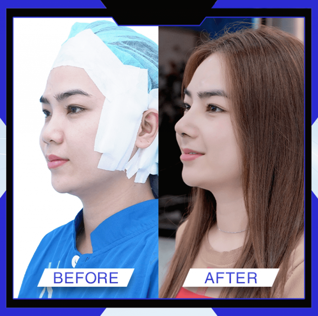 Thẩm Mỹ Ko Ko – Nét Đẹp Hoàn Mỹ