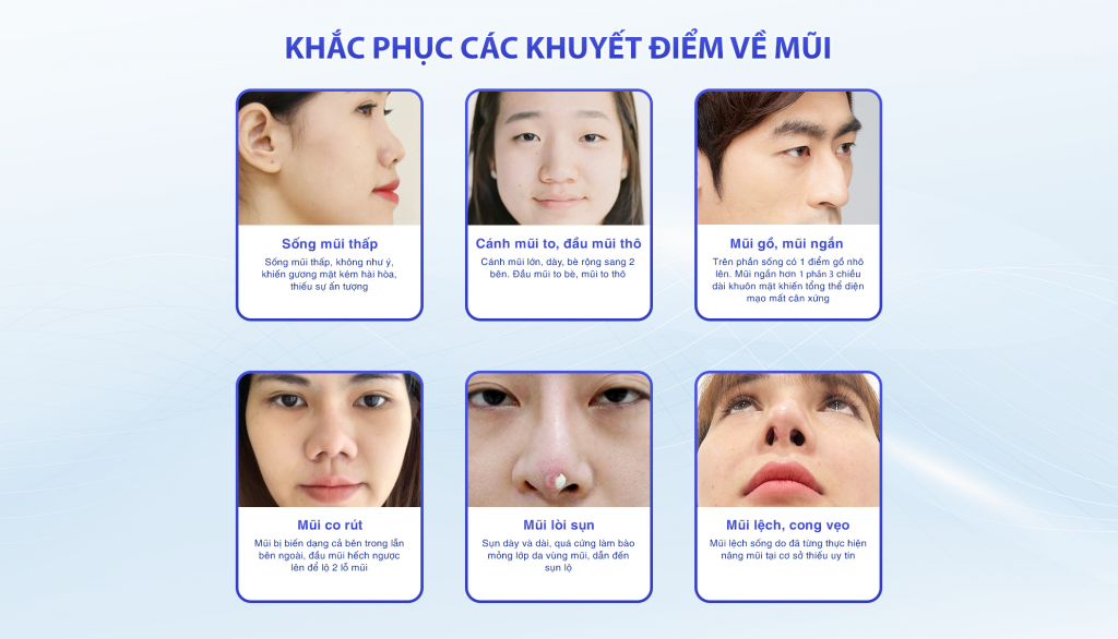 Thẩm Mỹ Ko Ko – Nét Đẹp Hoàn Mỹ
