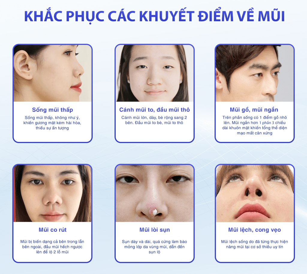 Thẩm Mỹ Ko Ko – Nét Đẹp Hoàn Mỹ