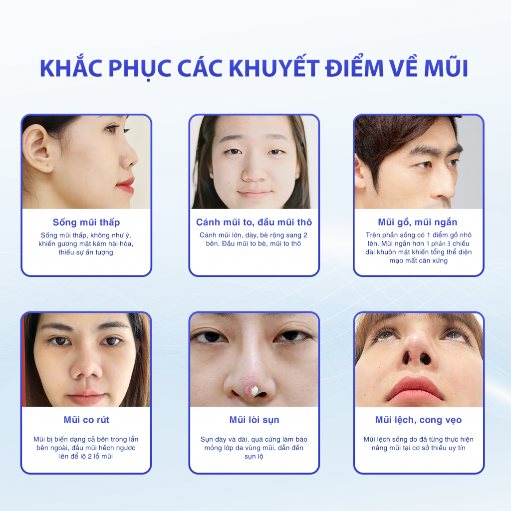 Thẩm Mỹ Ko Ko – Nét Đẹp Hoàn Mỹ