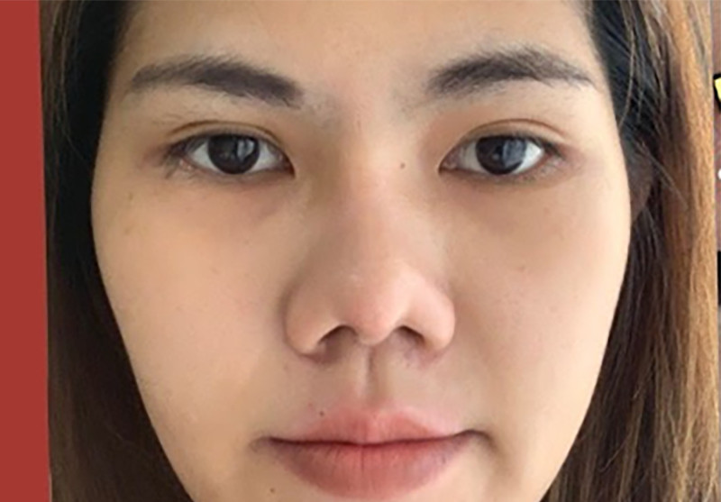 Thẩm Mỹ Ko Ko – Nét Đẹp Hoàn Mỹ