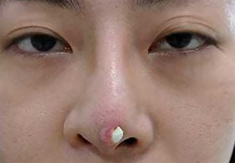 Thẩm Mỹ Ko Ko – Nét Đẹp Hoàn Mỹ