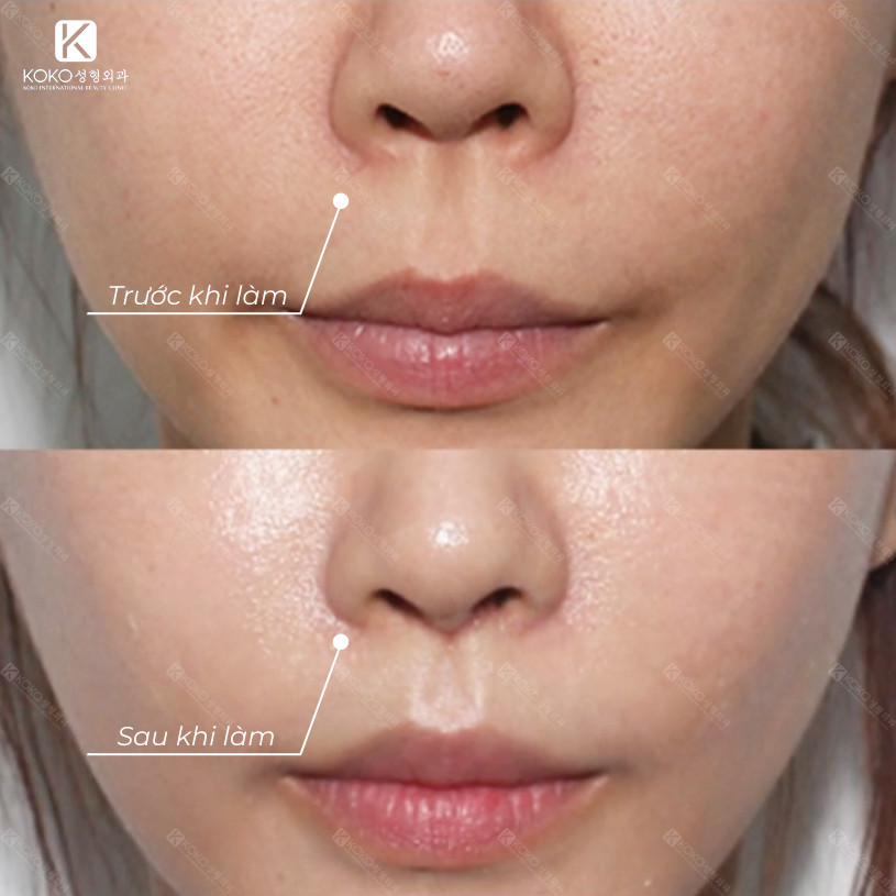Thẩm Mỹ Ko Ko – Nét Đẹp Hoàn Mỹ