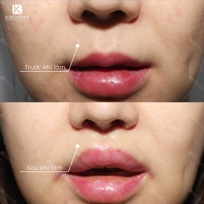 Thẩm Mỹ Ko Ko – Nét Đẹp Hoàn Mỹ