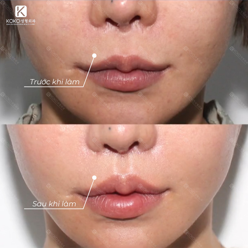 Thẩm Mỹ Ko Ko – Nét Đẹp Hoàn Mỹ