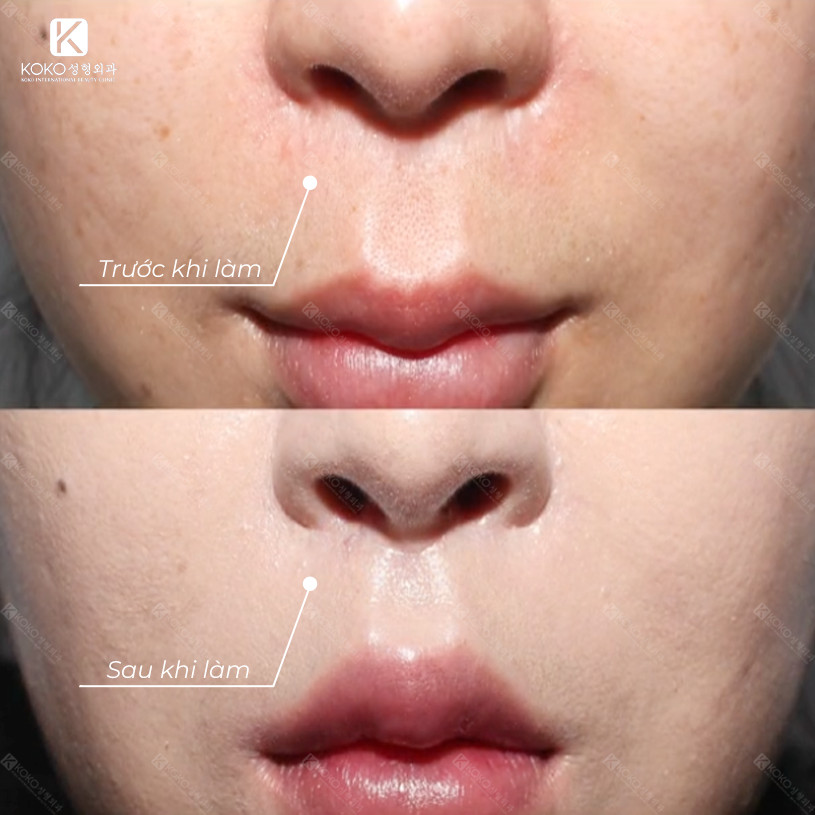 Thẩm Mỹ Ko Ko – Nét Đẹp Hoàn Mỹ