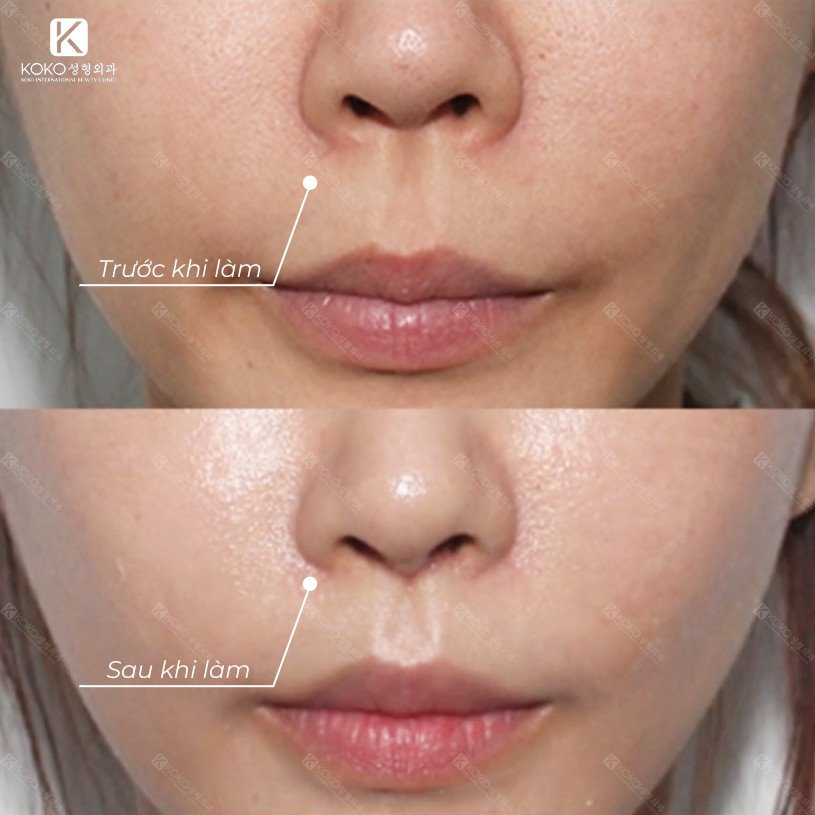 Thẩm Mỹ Ko Ko – Nét Đẹp Hoàn Mỹ