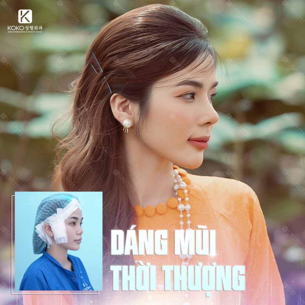 Dáng mũi phong thủy thời thượng