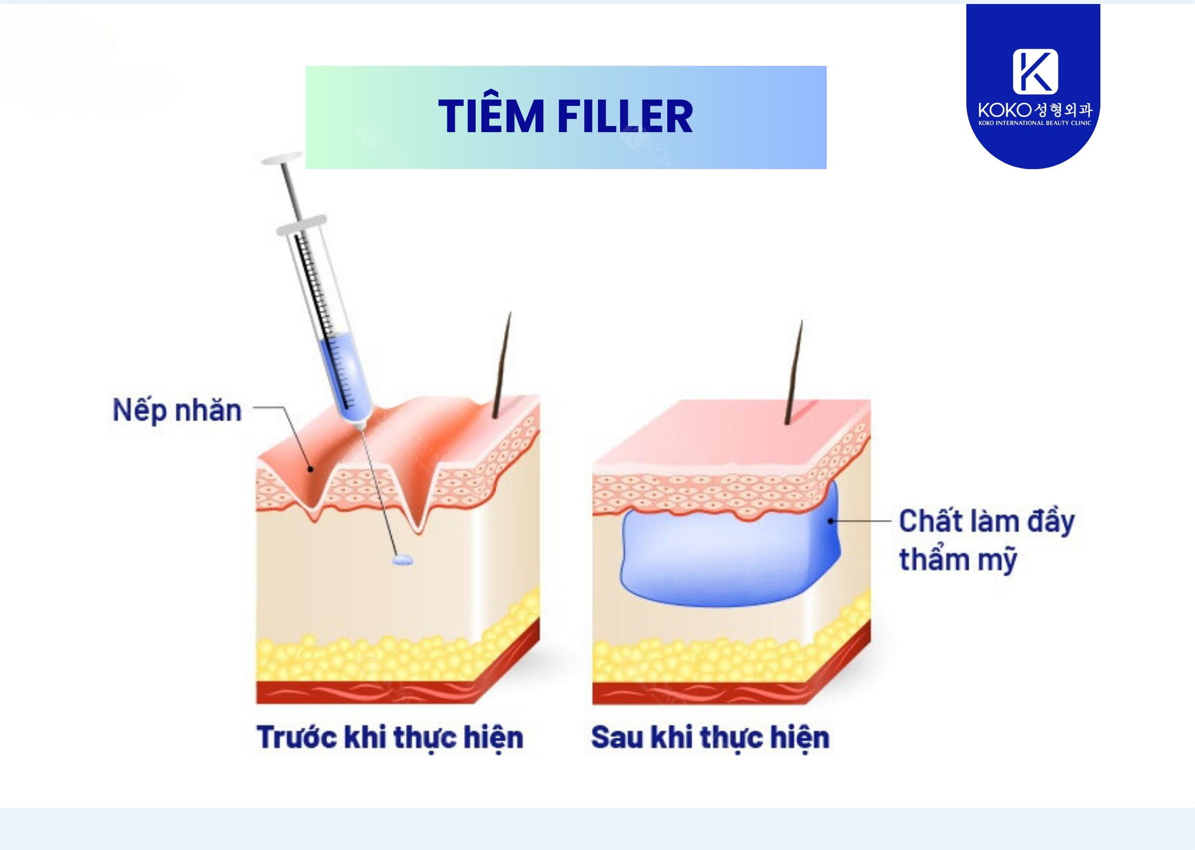 Cơ chế hoạt động của Filler