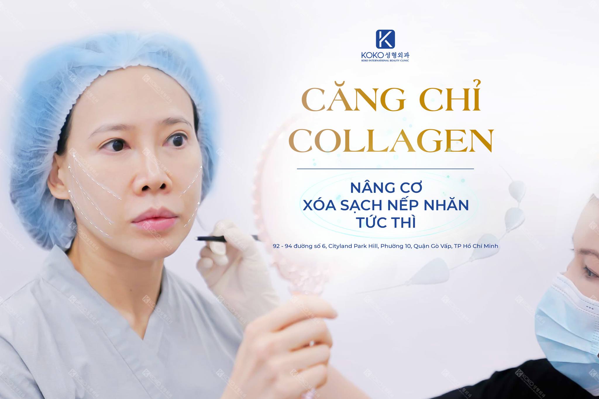 Căng da mặt bằng chỉ Collagen là gì?