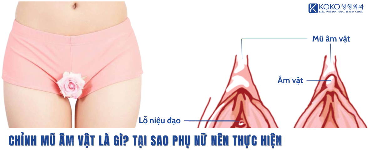 Chỉnh Mũ  Âm Vật Là Gì? Tại Sao Phụ Nữ Nên Thực Hiện?