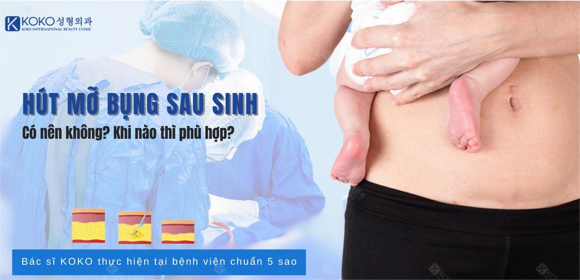 Sau sinh bao lâu thì được hút mỡ bụng?