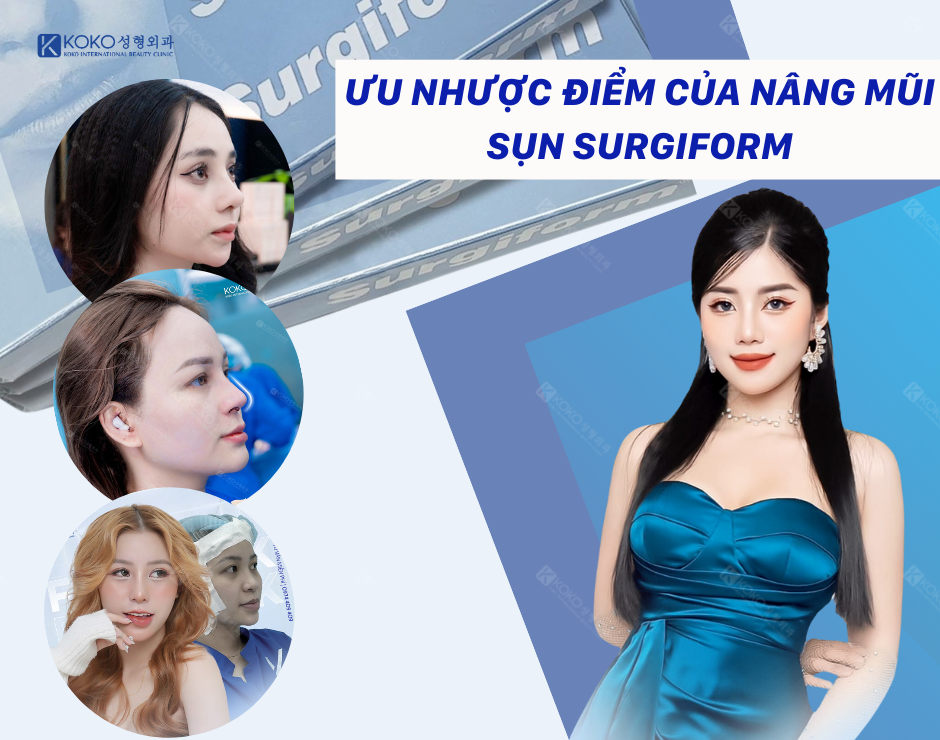 Ưu Nhược Điểm Của Nâng Mũi Sụn Surgiform