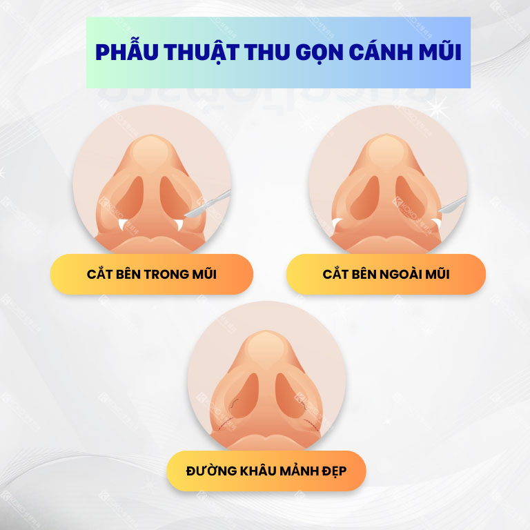 Ưu điểm của thu gọn cánh mũi