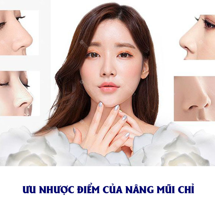 Ưu Nhược Điểm Của Phương Pháp Nâng Mũi Bằng Chỉ